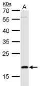 Anti-TSLP antibody used in Western Blot (WB). GTX129571
