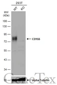 Anti-CD155 antibody used in Western Blot (WB). GTX129572