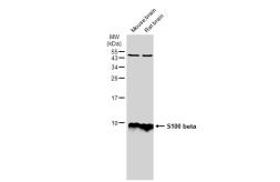 Anti-S100 beta antibody used in Western Blot (WB). GTX129573