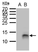 Anti-Elafin antibody used in Western Blot (WB). GTX129582