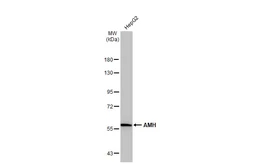 Anti-AMH antibody used in Western Blot (WB). GTX129593
