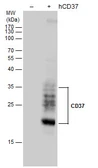 Anti-CD37 antibody used in Western Blot (WB). GTX129598