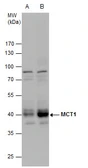 Anti-MCT1 antibody used in Western Blot (WB). GTX129599