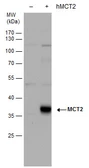 Anti-MCT2 antibody used in Western Blot (WB). GTX129600