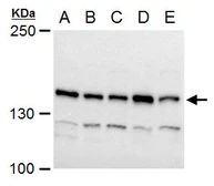Anti-Timeless antibody used in Western Blot (WB). GTX129604