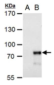 Anti-MBD4 antibody used in Western Blot (WB). GTX129605