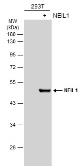 Anti-NEIL1 antibody used in Western Blot (WB). GTX129607