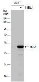 Anti-NEIL1 antibody used in Western Blot (WB). GTX129608
