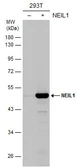 Anti-NEIL1 antibody used in Western Blot (WB). GTX129608