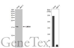 Anti-LMO4 antibody used in Western Blot (WB). GTX129616
