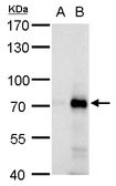 Anti-RNF168 antibody used in Western Blot (WB). GTX129617