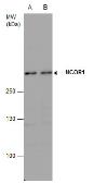 Anti-NCOR1 antibody used in Western Blot (WB). GTX129621