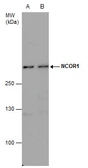 Anti-NCOR1 antibody used in Western Blot (WB). GTX129621