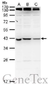 Anti-nm23-H7 antibody used in Western Blot (WB). GTX129626
