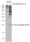Anti-Bcl-2 (phospho Ser70) antibody used in Western Blot (WB). GTX129653
