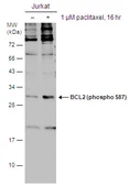 Anti-Bcl-2 (phospho Ser87) antibody used in Western Blot (WB). GTX129654