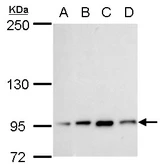 Anti-Transcription Termination Factor 1 antibody used in Western Blot (WB). GTX129671