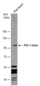 Anti-PGC1 beta antibody used in Western Blot (WB). GTX129682