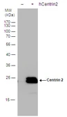 Anti-Centrin 2 antibody used in Western Blot (WB). GTX129709