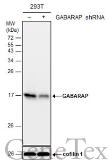 Anti-GABARAP antibody used in Western Blot (WB). GTX129710