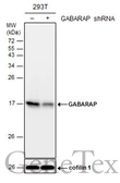 Anti-GABARAP antibody used in Western Blot (WB). GTX129710