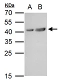 Anti-MT2 antibody used in Western Blot (WB). GTX129715