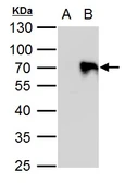 Anti-PIASy antibody used in Western Blot (WB). GTX129757