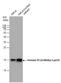 Anti-Histone H3K27me3 (Tri-methyl Lys27) antibody used in Western Blot (WB). GTX129774