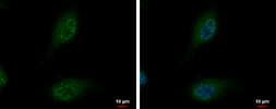 Anti-SON antibody used in Immunocytochemistry/ Immunofluorescence (ICC/IF). GTX129778