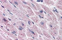 Anti-Endothelin A receptor antibody used in IHC (Paraffin sections) (IHC-P). GTX12978