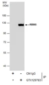 Anti-RBM5 antibody used in Immunoprecipitation (IP). GTX129783