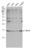 Anti-RPL31 antibody used in Western Blot (WB). GTX129792