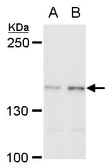 Anti-SFRS14 antibody used in Western Blot (WB). GTX129794