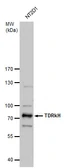 Anti-TDRKH antibody used in Western Blot (WB). GTX129795
