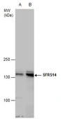 Anti-SFRS14 antibody used in Western Blot (WB). GTX129798