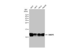 Anti-SNRPE antibody used in Western Blot (WB). GTX129801