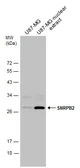 Anti-SNRPB2 antibody used in Western Blot (WB). GTX129802