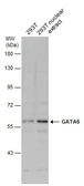Anti-GATA6 antibody used in Western Blot (WB). GTX129832