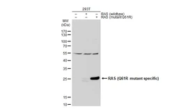 Anti-RAS (Q61R Mutant) antibody used in Western Blot (WB). GTX129834