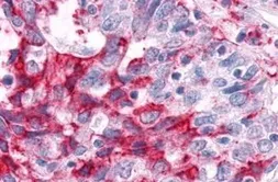 Anti-ERR alpha antibody used in IHC (Paraffin sections) (IHC-P). GTX12984