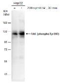 Anti-FAK (phospho Tyr397) antibody used in Western Blot (WB). GTX129840