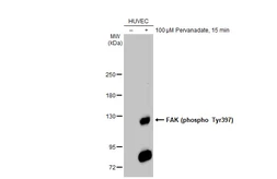 Anti-FAK (phospho Tyr397) antibody used in Western Blot (WB). GTX129840