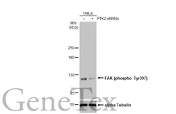 Anti-FAK (phospho Tyr397) antibody used in Western Blot (WB). GTX129840