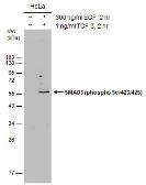 Anti-SMAD3 (phospho Ser423/425) antibody used in Western Blot (WB). GTX129841