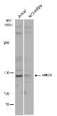 Anti-eNOS antibody used in Western Blot (WB). GTX129843