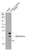 Anti-VEGF antibody used in Western Blot (WB). GTX129844