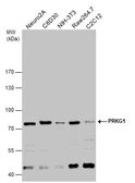 Anti-cGK1 antibody used in Western Blot (WB). GTX129845