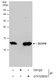 Anti-SEC61B antibody used in Immunoprecipitation (IP). GTX129852