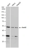 Anti-Sec62 antibody used in Western Blot (WB). GTX129853