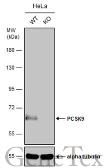 Anti-PCSK9 antibody used in Western Blot (WB). GTX129859